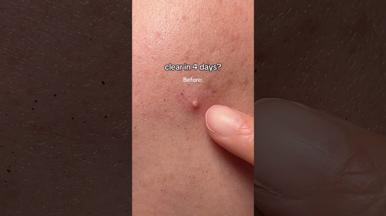 1765491908 maxresdefault