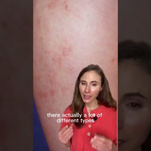 1765496379 maxresdefault