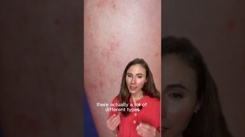 1765496379 maxresdefault