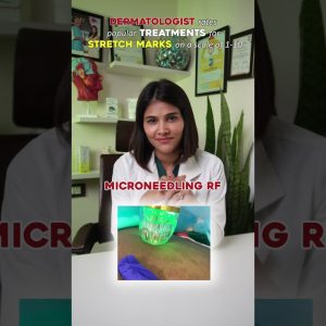 1765503723 maxresdefault