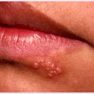 1765509738 maxresdefault