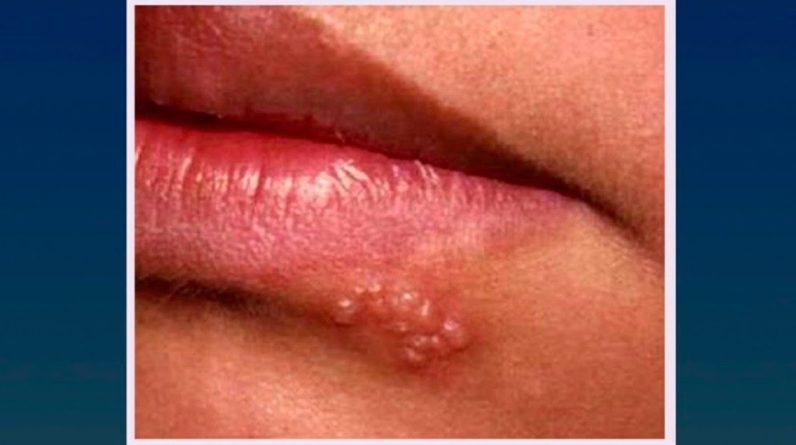 1765509738 maxresdefault