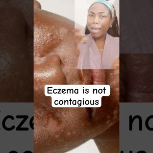 1765512119 maxresdefault