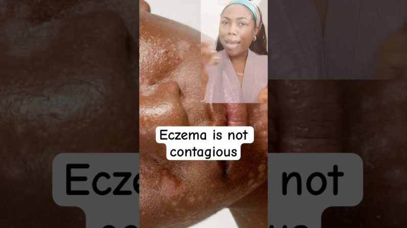 1765512119 maxresdefault