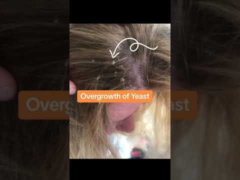 1765520938 hqdefault