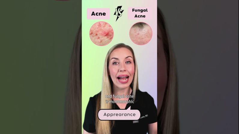 1765573466 maxresdefault