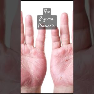 1765575654 maxresdefault