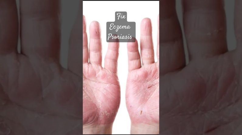 1765575654 maxresdefault