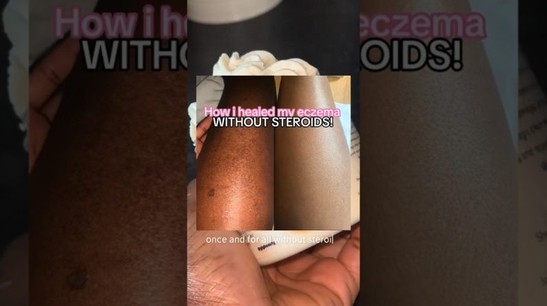 1765585254 maxresdefault