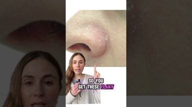 Unveiling The Secrets Of Dry Nose Skin 16 1765595414 maxresdefault