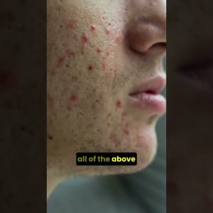 1765597608 maxresdefault