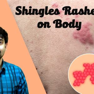 1765604970 maxresdefault