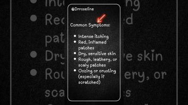 1765605145 maxresdefault