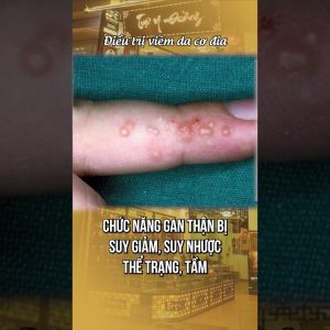 1765616034 maxresdefault