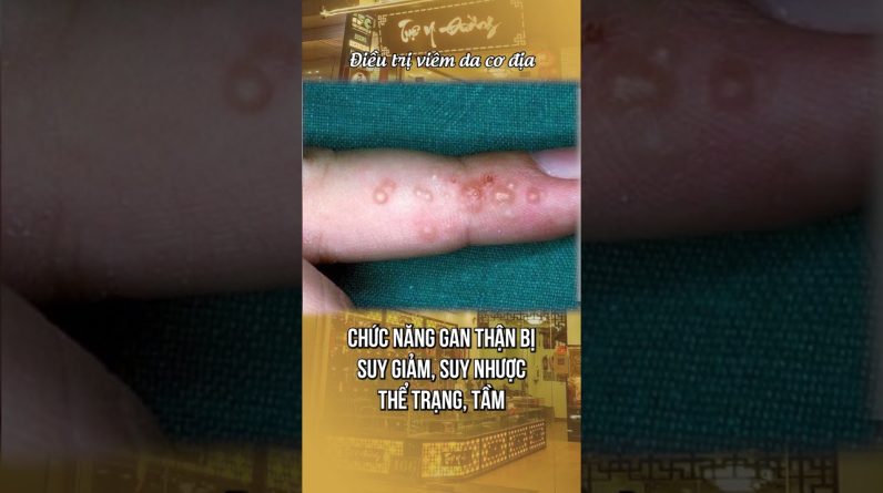 1765616034 maxresdefault