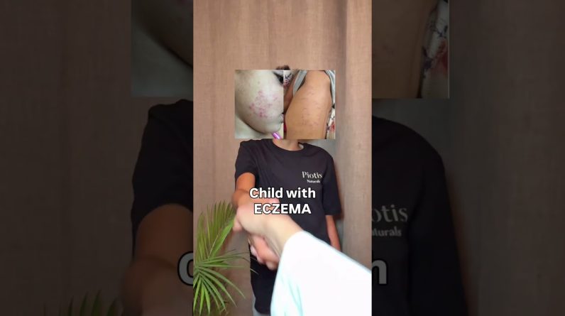 1765618225 maxresdefault