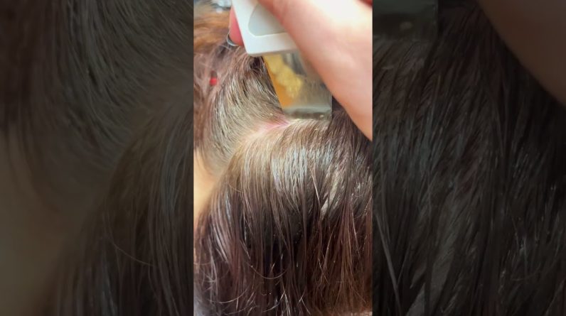 1765629184 maxresdefault