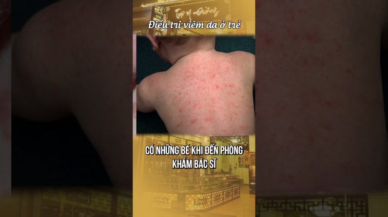 1765630680 maxresdefault