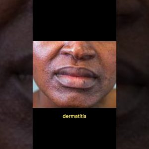 1765632011 maxresdefault