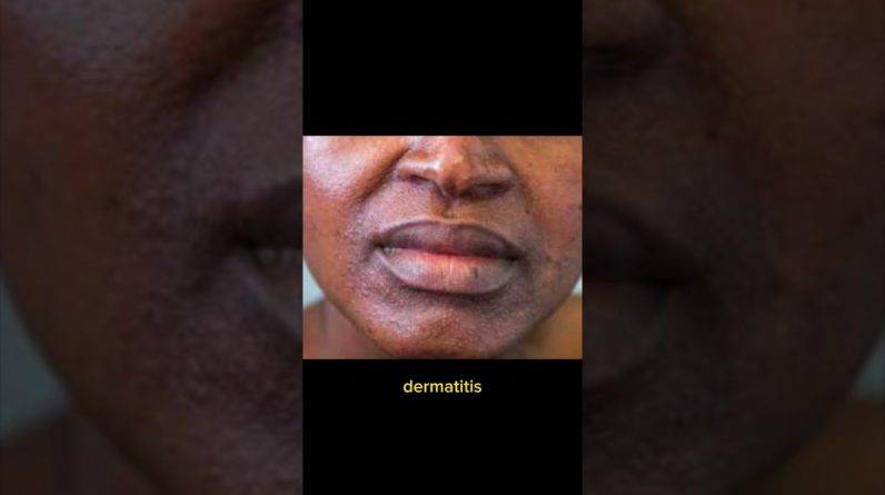 1765632011 maxresdefault