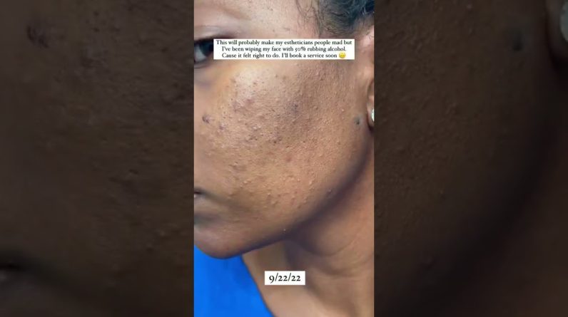 1765650237 maxresdefault