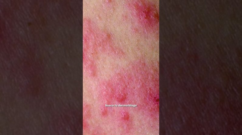 1765654823 maxresdefault