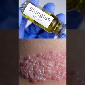 1765659955 maxresdefault