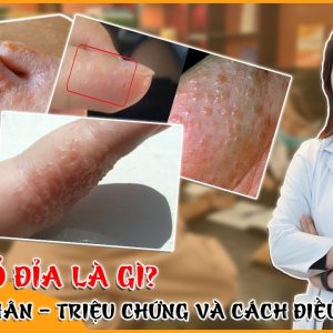 1765674648 maxresdefault