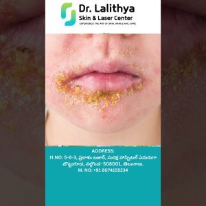 1765681999 maxresdefault