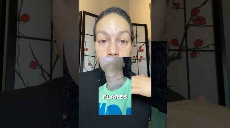 1765689419 maxresdefault