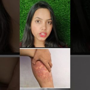 1765694344 maxresdefault