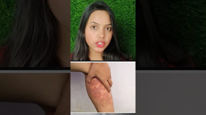 1765694344 maxresdefault