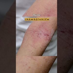 1765700277 maxresdefault