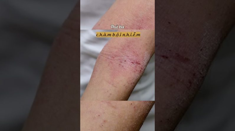 1765700277 maxresdefault