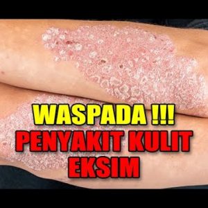 1765707597 hqdefault