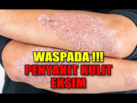 1765707597 hqdefault