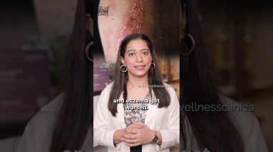 1765715215 maxresdefault