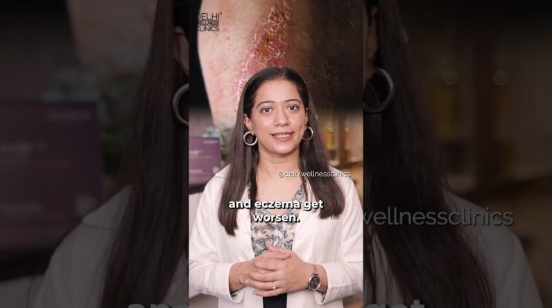 1765715215 maxresdefault