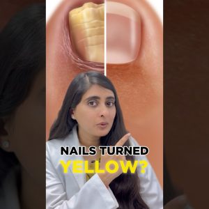 1765727990 maxresdefault