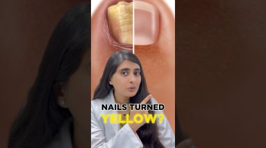 1765727990 maxresdefault