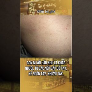 1765755295 maxresdefault