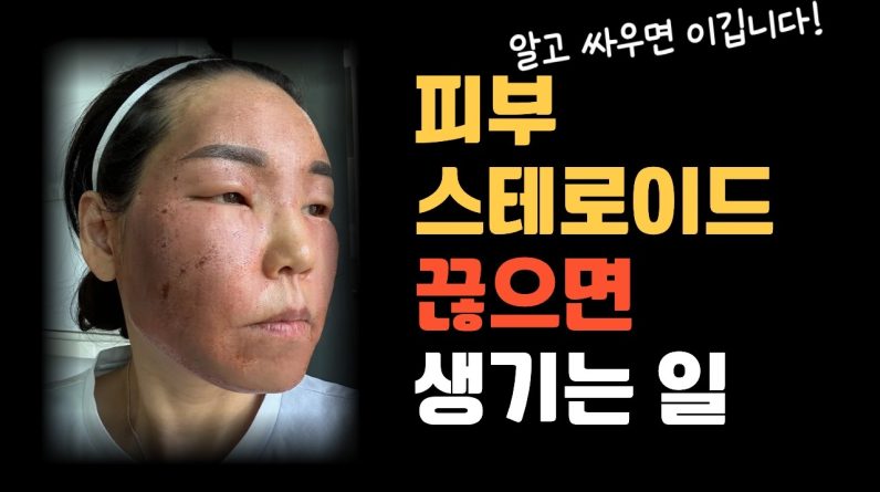 1765793159 maxresdefault