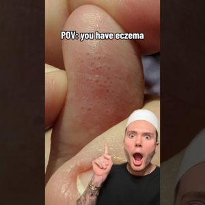 1765795795 maxresdefault