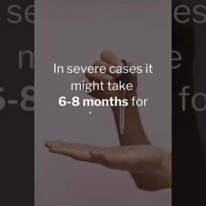 1765828832 maxresdefault