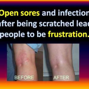 1765835956 hqdefault