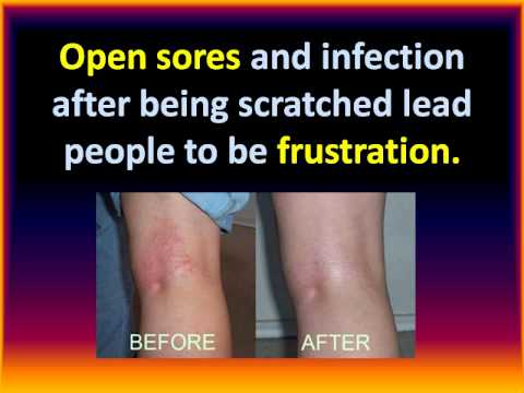 1765835956 hqdefault