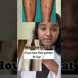 1765840815 maxresdefault