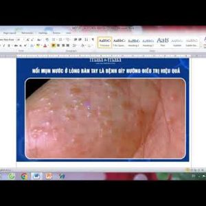 1765854240 hqdefault