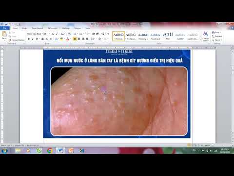 1765854240 hqdefault