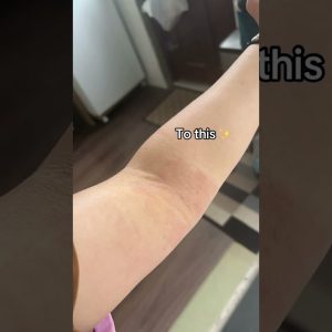 1765859756 maxresdefault